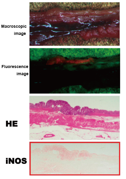 Fig. 2: Histological images of a surgical specimen of cancer (red frame: immunohistological staining)
