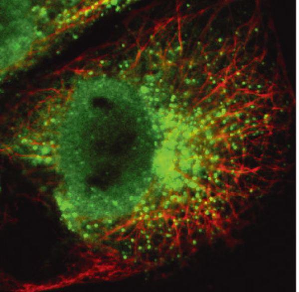 図1：細胞核で複製したウイルスゲノムが微小管により輸 送されている様子 赤：微小管、　緑：ウイルスゲノム