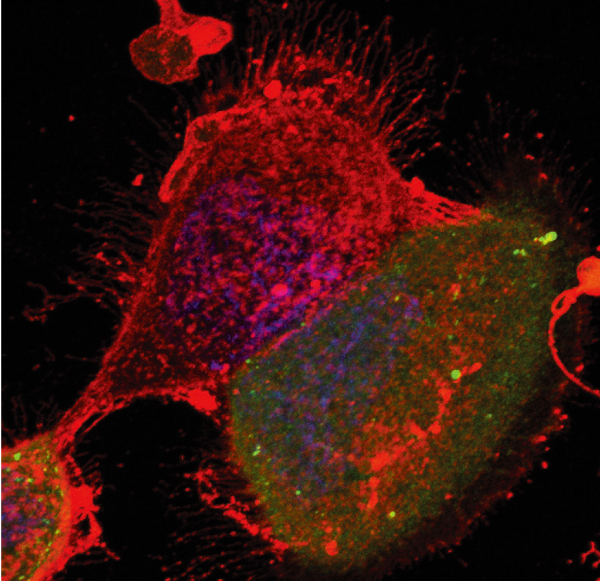 図2：ウイルス粒子が細胞から繊維状に出芽している様子 赤と緑：ウイルス感染細胞　　青：細胞核